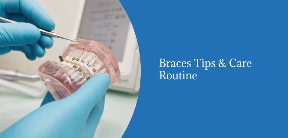 Braces Tips & Care Routine