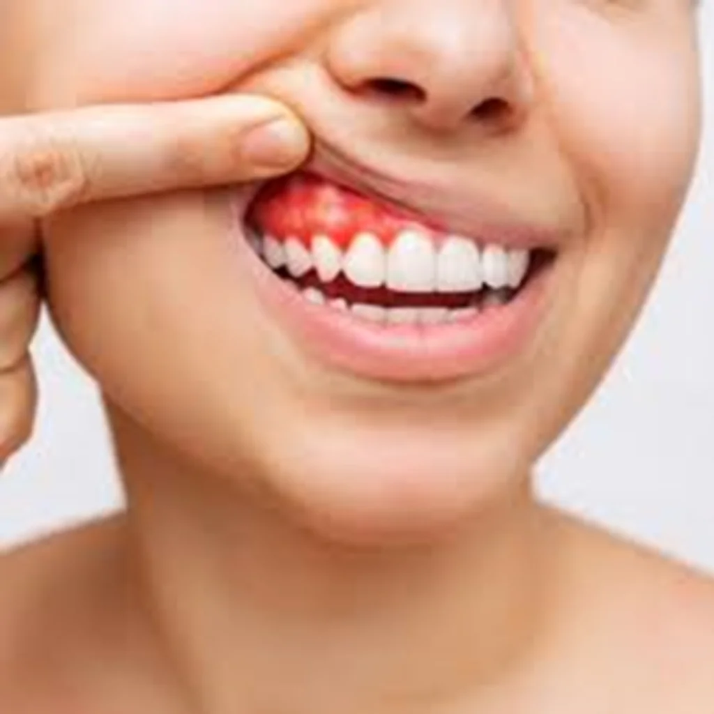 Vitamin C Deficiency & Oral Health | Why It Matters for Your Smile