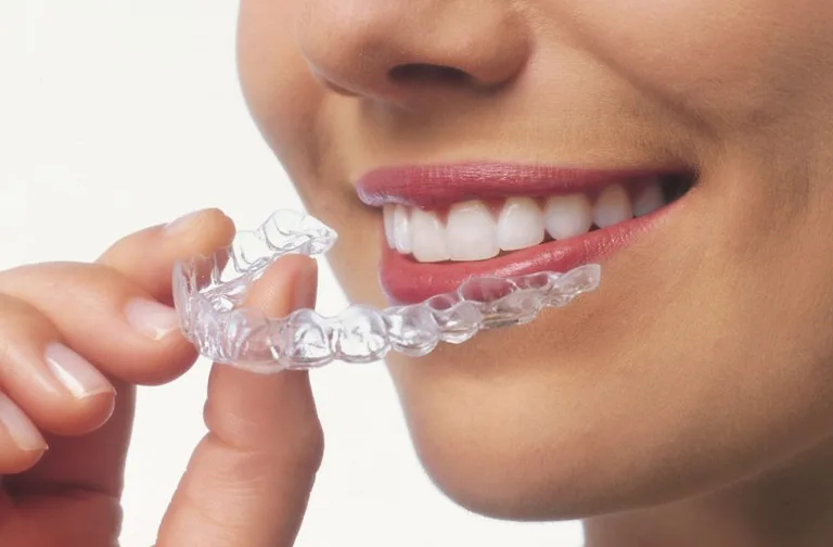 Clear aligners for teeth straightening at Crossroads Dental Clinic in Sheikh Zayed Road and Deira, Dubai – Invisible orthodontic treatment for a perfect smile