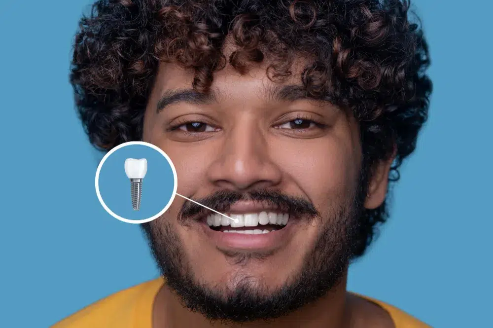 Dental Implant in Dubai