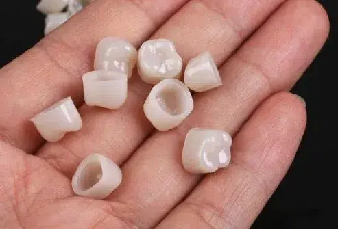 Temporary dental crowns at Crossroads Dental Clinic Dubai Sheikh Zayed Road and Deira for tooth protection and smile restoration