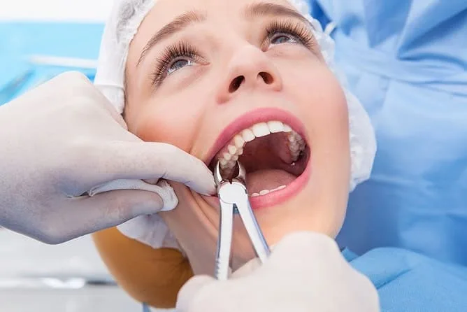 Wisdom tooth extraction at Crossroads Dental Clinic in Dubai, safe and painless removal at Sheikh Zayed Road and Deira dental clinics