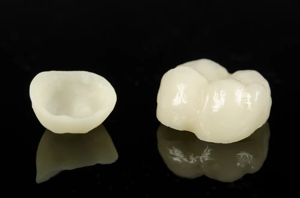All-Ceramic and All-Porcelain Dental Crowns in Dubai at Crossroads Dental Clinic Sheikh Zayed Road and Deira, restoring teeth with natural-looking crowns for a confident smile.