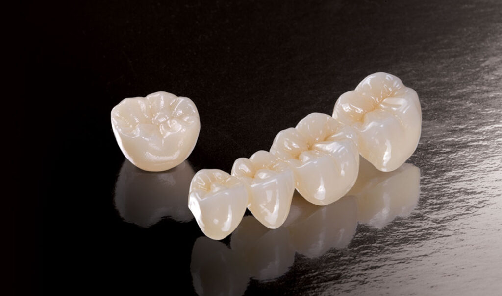 Dental Crown and Bridges in Dubai