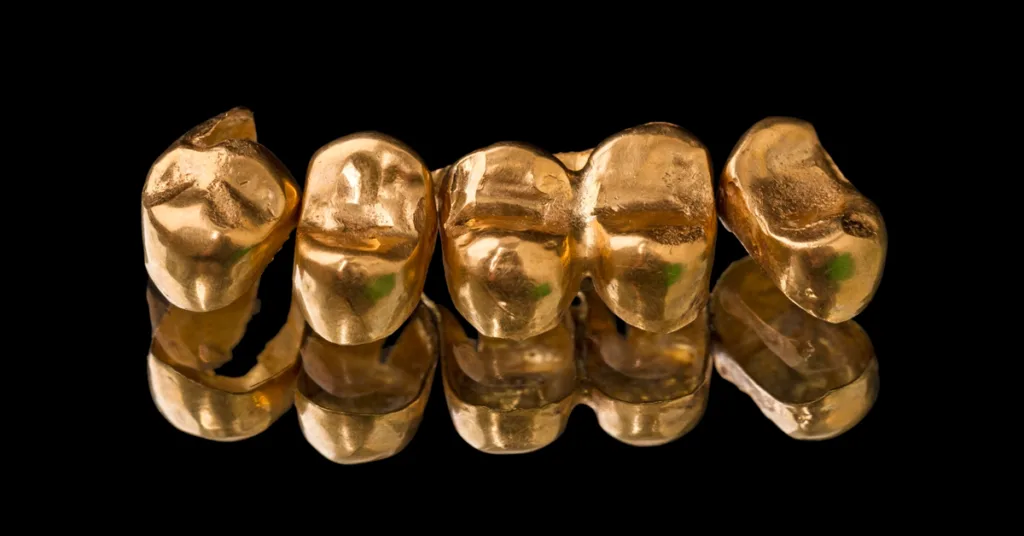 Gold dental crowns in Dubai at Crossroads Dental Clinic Sheikh Zayed Road and Deira for strong, durable tooth restoration