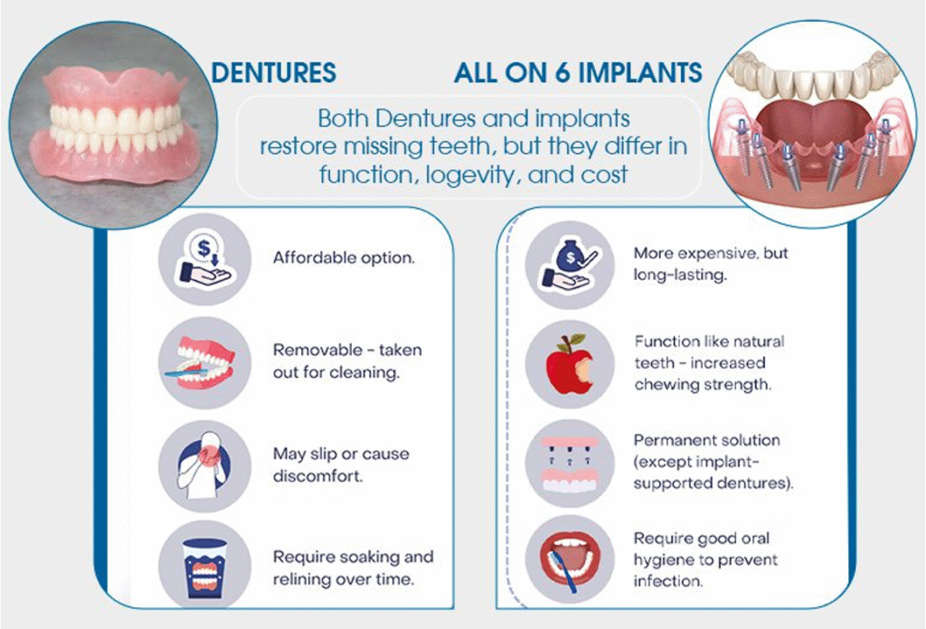 All on 6 Implants vs Dentures Dubai comparison chart