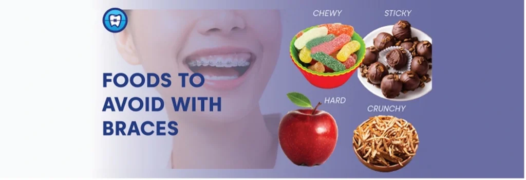 Illustration showing types of foods to avoid with braces such as apples, chewy candies, sticky chocolate, and crunchy snacks.