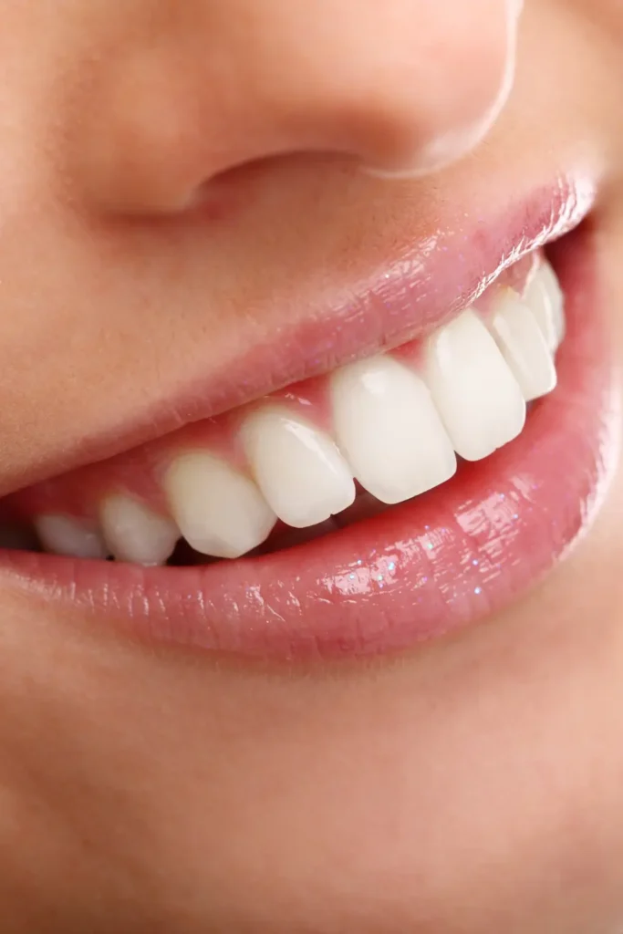 Close-up photo of clean, white teeth and healthy gums, illustrating the importance of replacing an extracted tooth to maintain oral health.