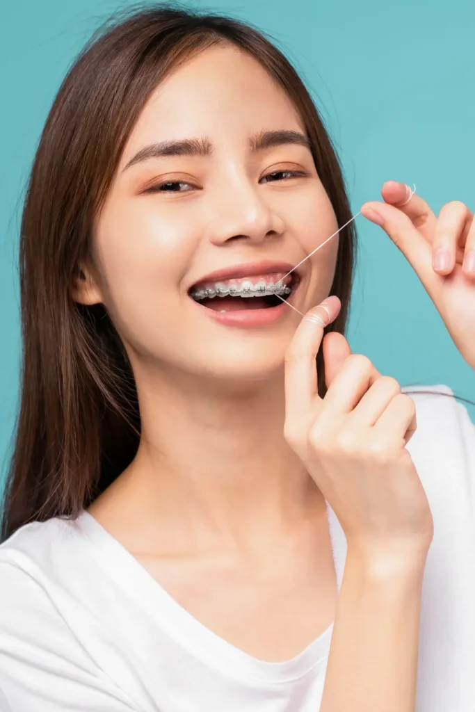 Flossing tools used with braces to remove plaque and prevent white spot lesions