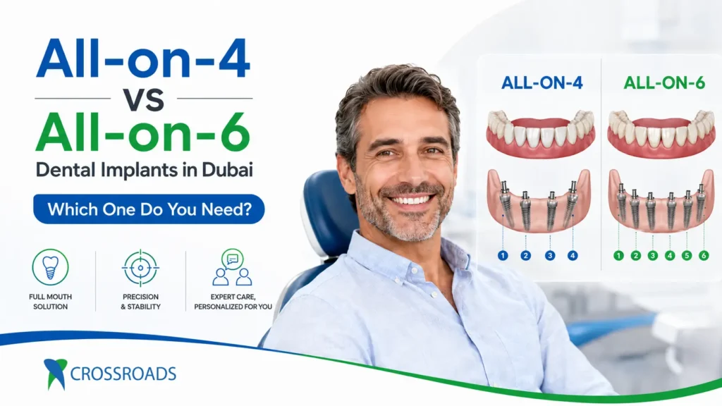 All-on-4 implants Dubai for full mouth teeth replacement